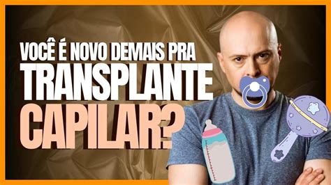 Descubra Nesse V Deo Sou Muito Jovem Pra Fazer Transplante Capilar