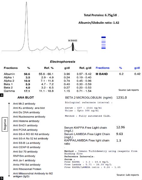 Diagnostic Tests For Monoclonal Gammopathy Of Unknown Significance A