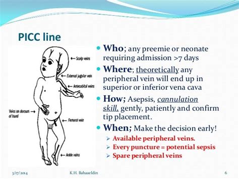 Pin By Nonas Arc On Picc Line Peripherally Inserted Central Catheter