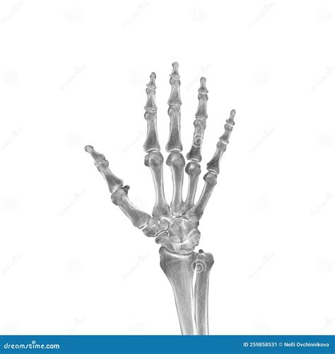 The X-ray Shows a Part of the Human Skeleton, the Hand Stock Image ...