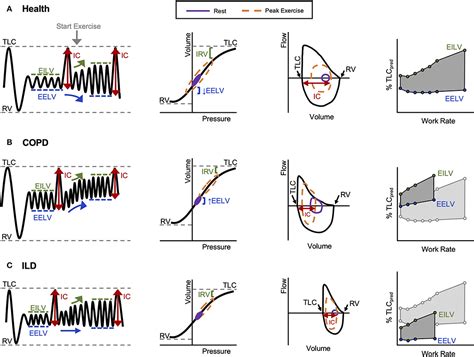 Frontiers Evaluation Of Dynamic Respiratory Mechanical Abnormalities