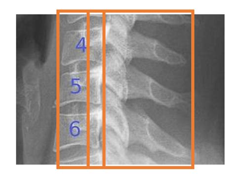 Musculoskeletal Radiograph Interpretation Specific Approach By Joint