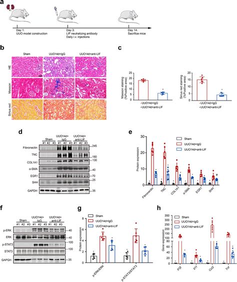 Neutralizing LIF Antibody Attenuated Renal Fibrosis Induced By UUO A