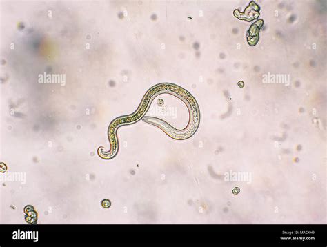 Tapeworm In Dogs Microscope