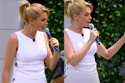 Ana Hickmann aparece hematoma após agressão Viver Diario de