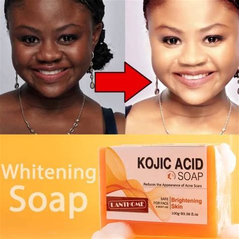 Savon L Acide Kojique Kojic Acid Regina Handmade Whitening And