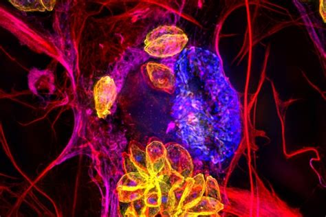 Anticipating and countering infectious diseases | Whitehead Institute