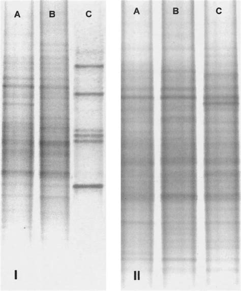 Dgge Pro Fi Les Of 200 Bp 16s Rrna Gene Fragments Panel I Represents Download Scientific