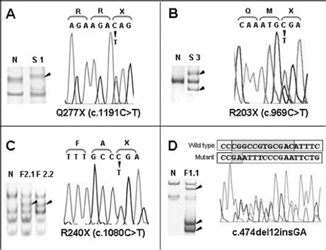 Four Mutations Of The Pax6 Gene Were Identified Through Sscp Analysis