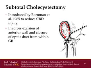 Socal Acs Subtotal Cholecystectomies Ppt