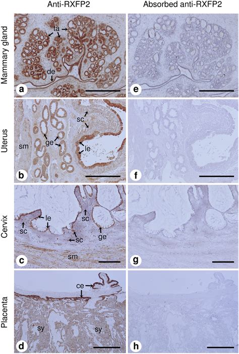 Immunohistochemical Localization Of Rxfp2 Protein In Extra Ovarian