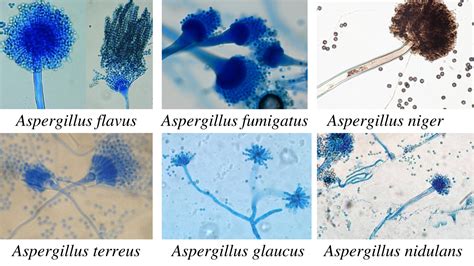 Aspergillus Morphology Clinical Features And Lab Diagnosis • Microbe Online