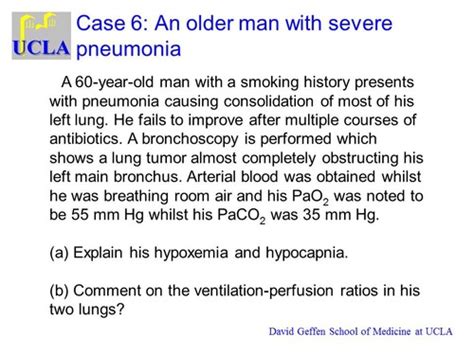 MS1 B2W5L2 MATCHING VENTILATION AND PERFUSION Dr Cooper Flashcards