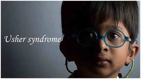 Usher Syndrome All You Need To Know About It