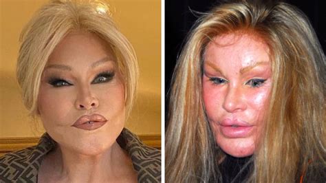 Catwoman Jocelyn Wildenstein Looks Truly Unrecognisable In Throwback