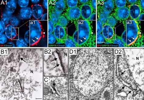 Sp Associates With Perinuclear Endoplasmic Reticulum Of Dentate Granule