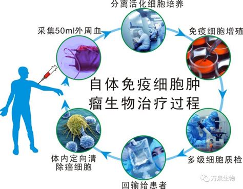 癌症肿瘤自体免疫细胞治疗自体细胞免疫疗法全球肿瘤医生网