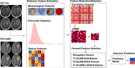 Scheme Of The Mri Radiomic Framework For Srt Outcome Prediction