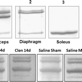 Electrophoretic Separation Of The Various Myosin Heavy Chain Protein