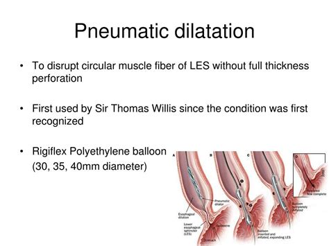 Ppt Updates On The Management Of Achalasia Powerpoint Presentation