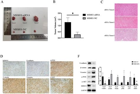 MSMO1 Silencing Stimulated Cell Proliferation In Subcutaneous Tumor