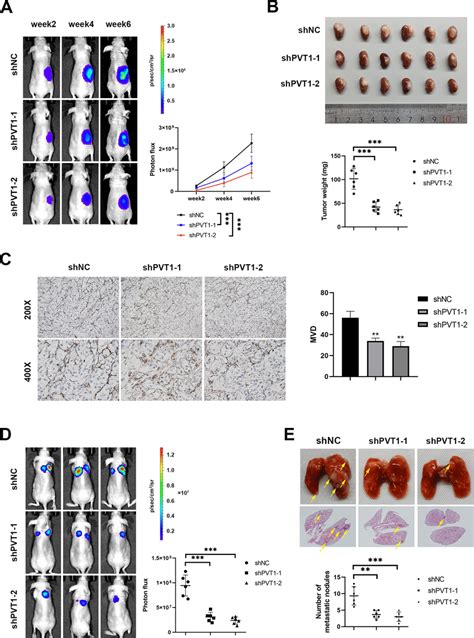 PVT1 Promotes CcRCC Proliferation Angiogenesis And Metastasis In