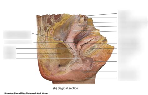 15 Female Repro Cadaver Diagram Quizlet