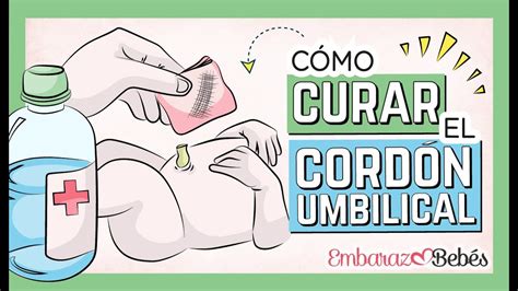 Qu Hacer Cuando Se Cae El Cord N Umbilical Gu A Completa De Cuidados