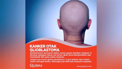 Waspadai Bahaya Kanker Otak Glioblastoma Times Indonesia