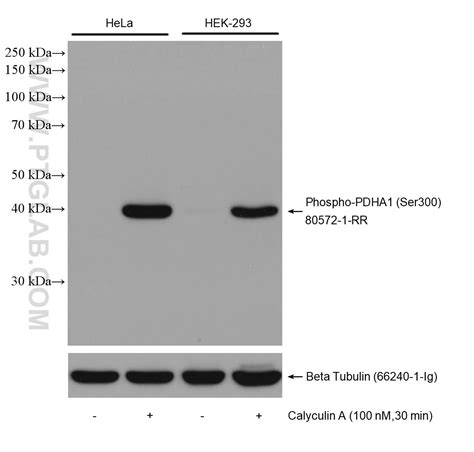 Phospho Pdh E Alpha Ser Antibody Rr Proteintech