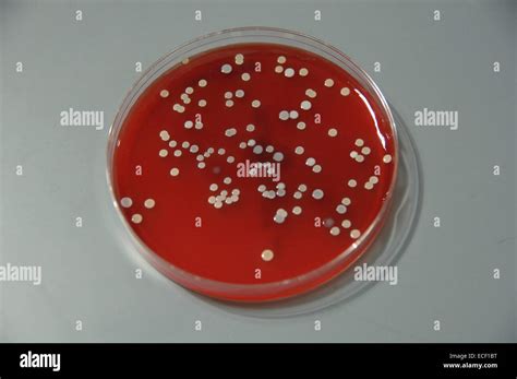 Las Bacterias De La Piel Humana Cultivadas En Agar En El Laboratorio