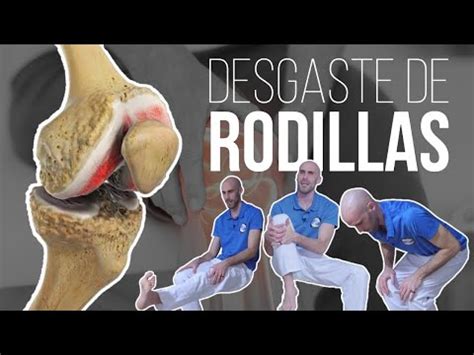 Artrosis De Rodilla Fisioterapia A Tu Alcance