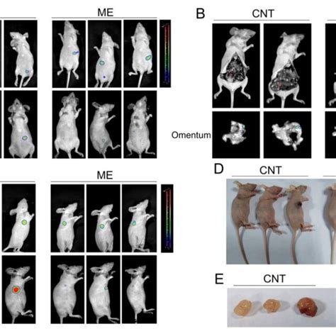 Me Treatment Inhibits The Growth Of Ovarian Tumors In Vivo A Nude