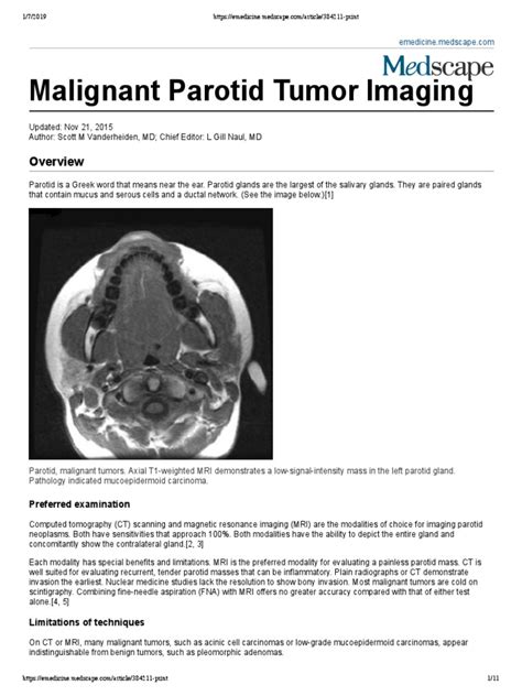 Malignant Parotid Tumor Imaging Pdf Medical Imaging Adenoma