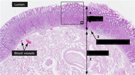 Anatomy Lab Quiz Digestive System Flashcards Quizlet