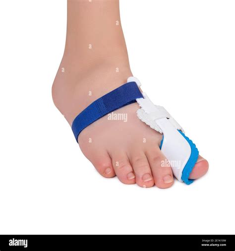 Herramientas Para El Cuidado De Los Pies Corrector De Bunion De Un