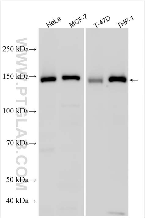 Flightless I Rabbit Anti Human Polyclonal Proteintech Fisher