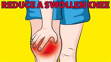 How To Reduce A Swollen Knee With Only 6 Movements Youtube