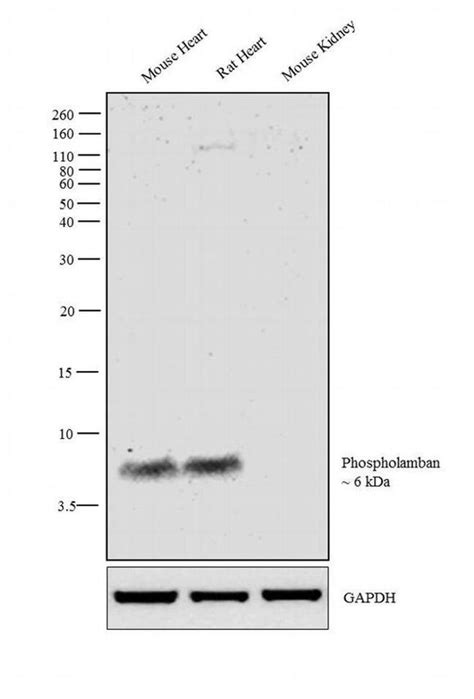 Phospholamban Polyclonal Antibody Pa5 26004