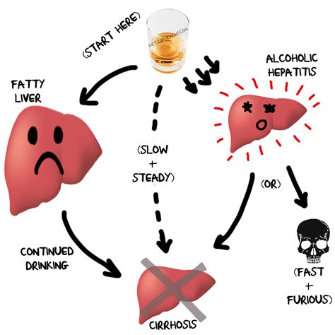 Precision Digestive Care » How Exactly Does Alcohol Cause Liver Problems?