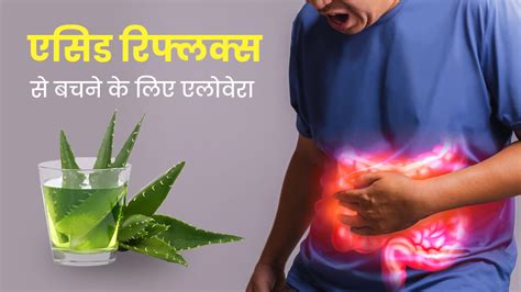 एसिड रिफ्लक्स से बचने के लिए ऐसे करें एलोवेरा का इस्तेमाल मिलेंगे