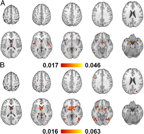 Neural Substrates Of Sexual Arousal Are Not Sex Dependent Pnas