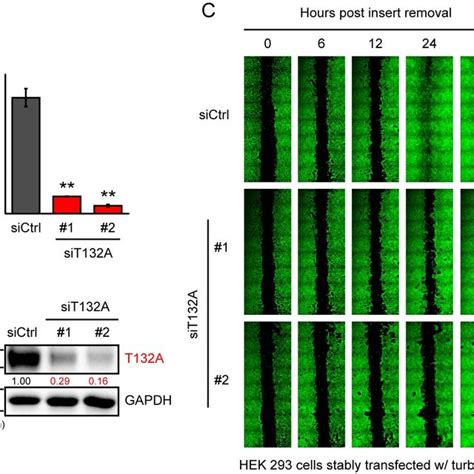 Tmem132a Regulates Cell Migration In Wound Healing Assay In Hela Cells