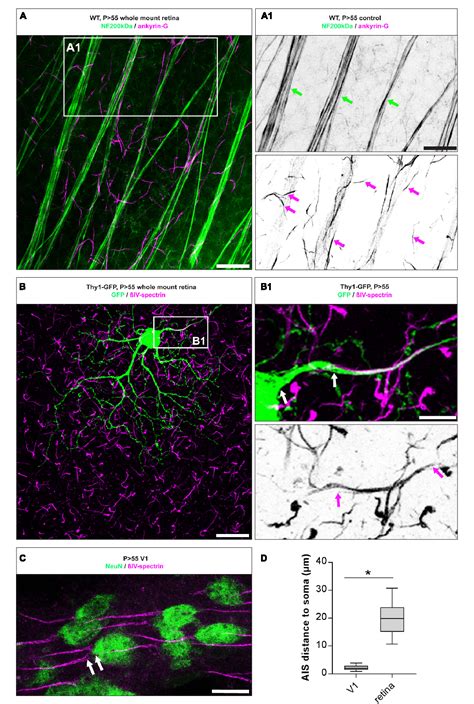 Figure 1 From Dynamic Regulation Of Synaptopodin And The Axon Initial