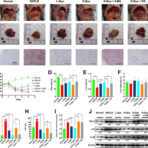 Quercetin Attenuates Lipid Accumulation Via An Autophagy Dependent