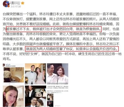 網傳林志玲遭家暴「打斷鼻骨」，黑澤良平：婚後互相尊重理性溝通 壹讀