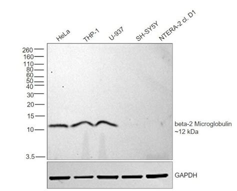 Beta 2 Microglobulin Monoclonal Antibody B2m 02 Ma1 19413