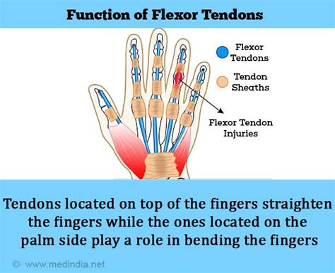 Flexor Tendon Injuries Causes Symptoms Diagnosis Treatment Outcome