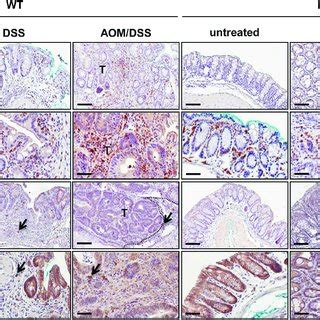 Mdr A Ko Mice Exhibit Increased Numbers Of B Cells And Plasma Cells In