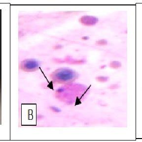 Giemsa Stain Of Tick Hemolymph Cells Infected With Anaplasma